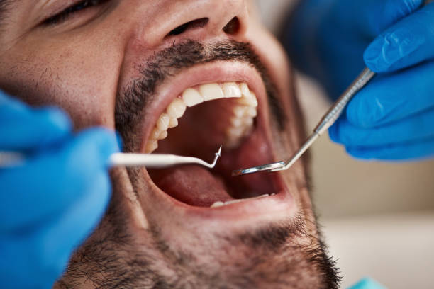 Best Tooth Extraction  in Dunn, NC